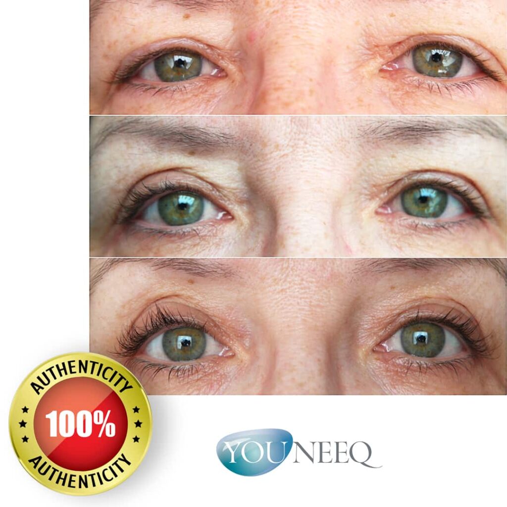 Eyecatcha Wimpern Booster vorher nachher Bilder