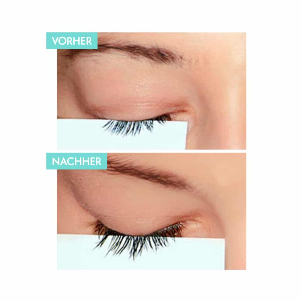 Realash vorher nachher Bilder